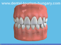 Tongue cleansing is important! - Dentistry Hungary